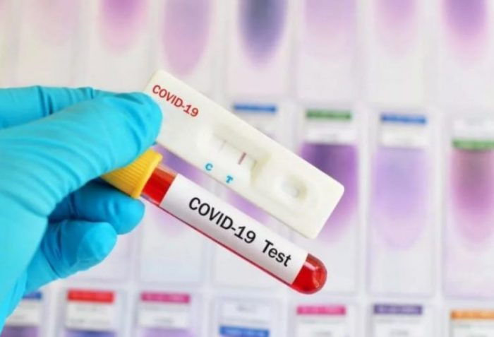 ПЦР тест на коронавирус — что это такое и как проводится анализ